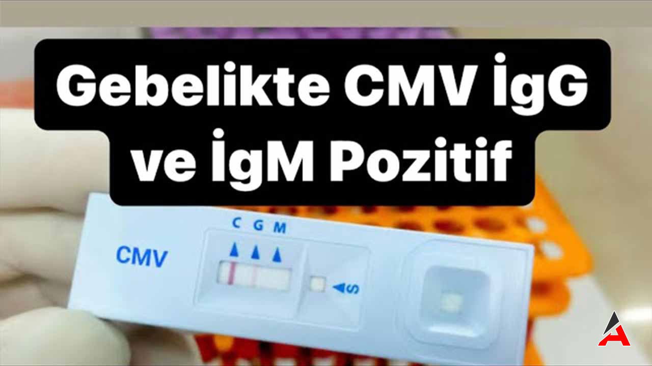 anti-cmv-igg-pozitif.jpg