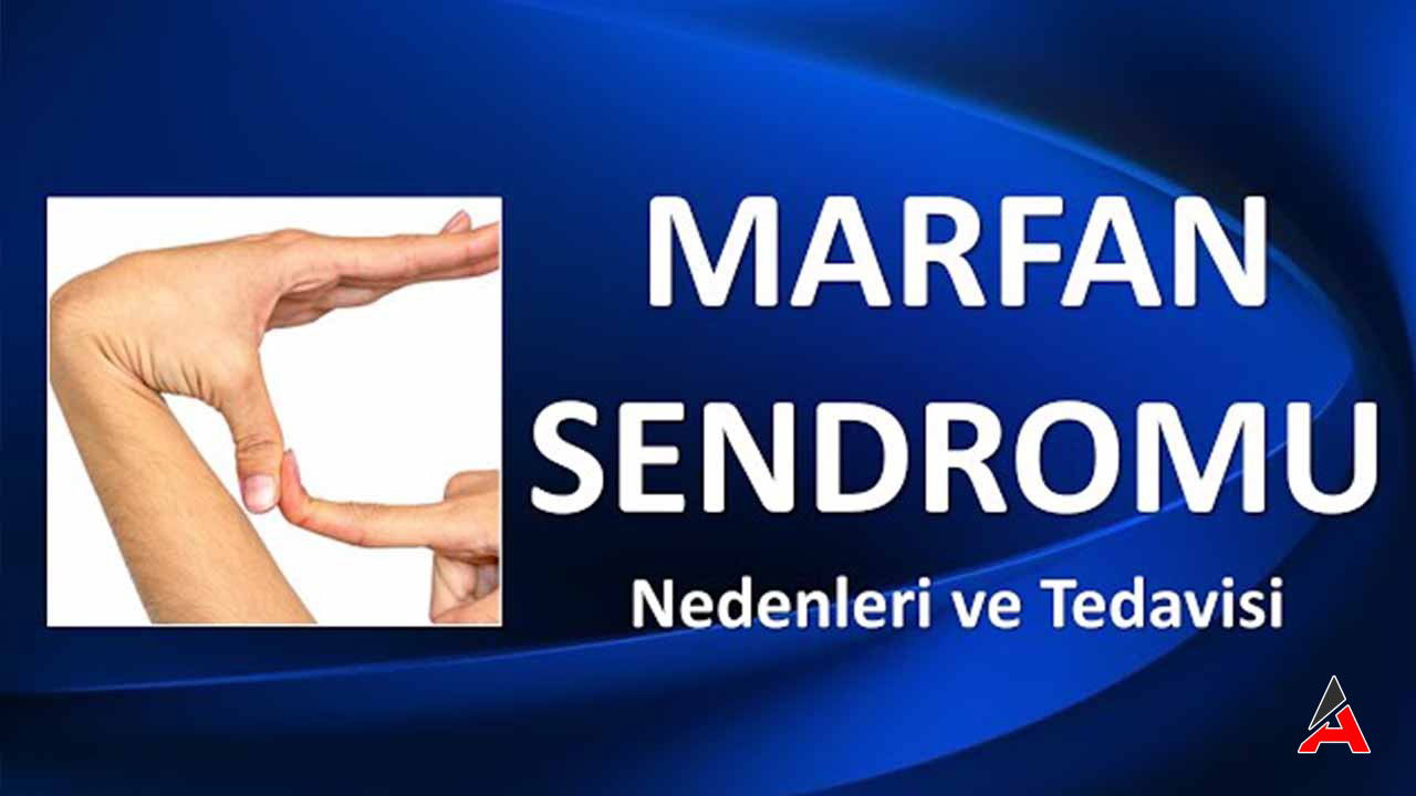 marfan-sendromu-nedir.jpg