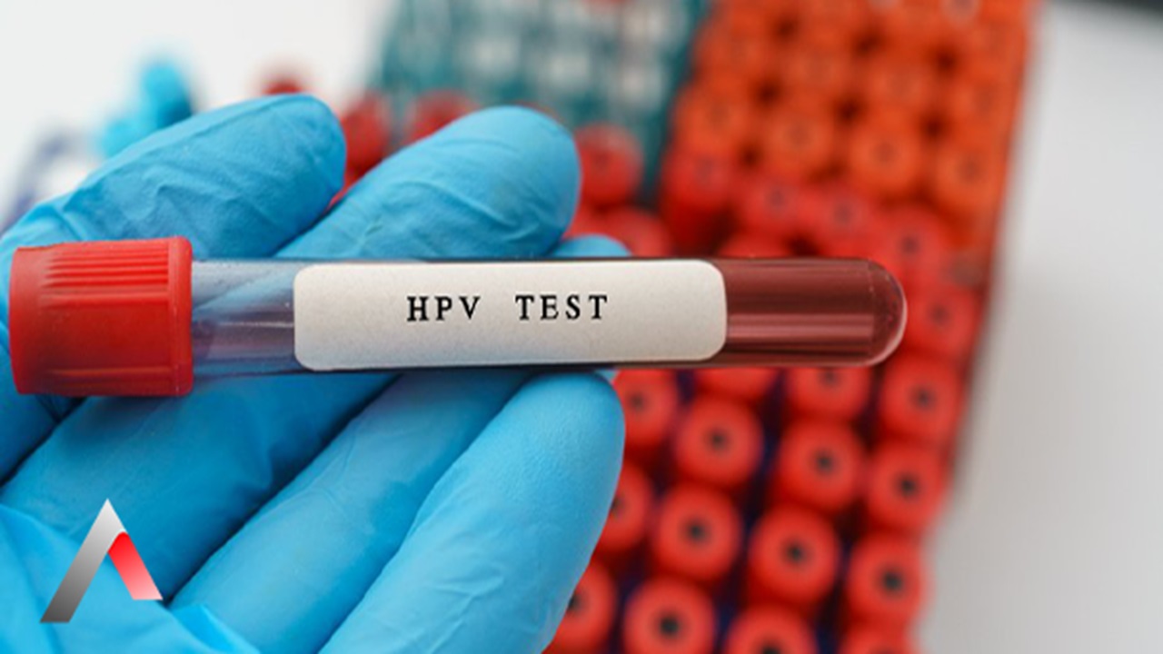 HPV Testi Nasıl Yapılır Adım Adım Bilgilendirme